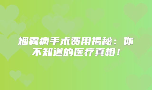 烟雾病手术费用揭秘：你不知道的医疗真相！
