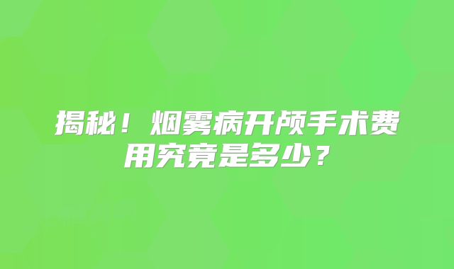 揭秘！烟雾病开颅手术费用究竟是多少？