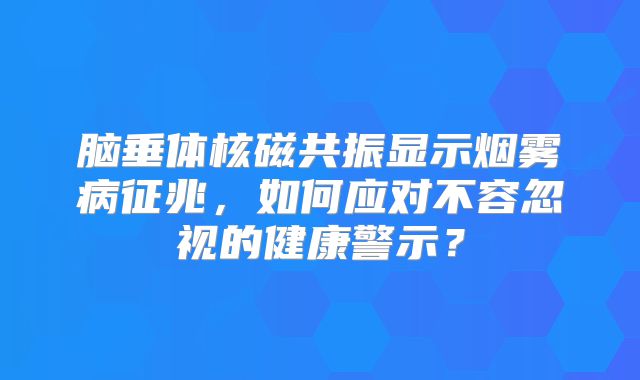 脑垂体核磁共振显示烟雾病征兆，如何应对不容忽视的健康警示？