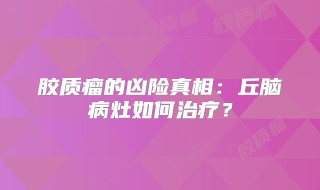 胶质瘤的凶险真相：丘脑病灶如何治疗？