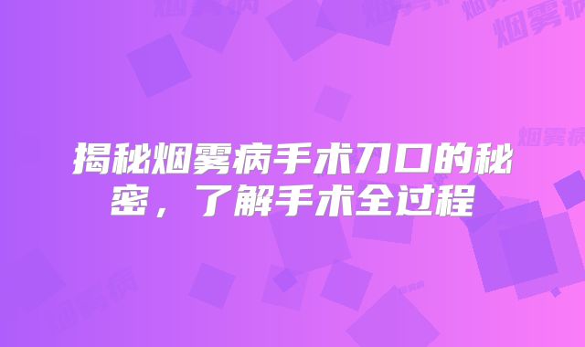 揭秘烟雾病手术刀口的秘密，了解手术全过程