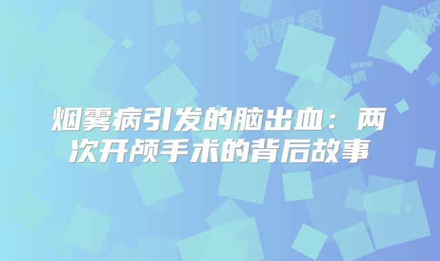 烟雾病引发的脑出血：两次开颅手术的背后故事