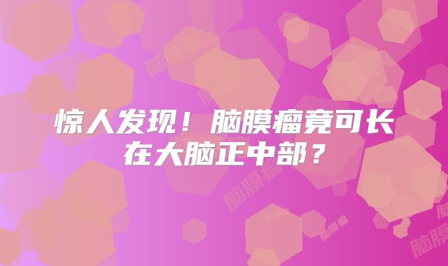 惊人发现！脑膜瘤竟可长在大脑正中部？