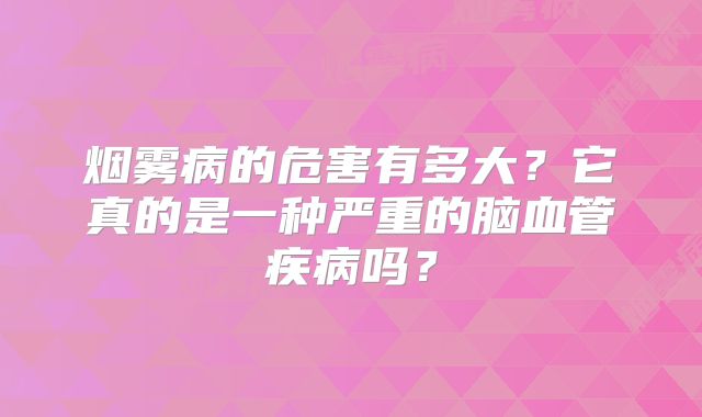 烟雾病的危害有多大？它真的是一种严重的脑血管疾病吗？