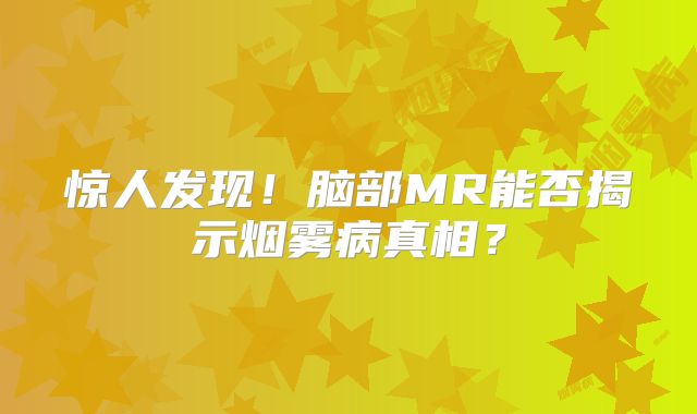 惊人发现！脑部MR能否揭示烟雾病真相？
