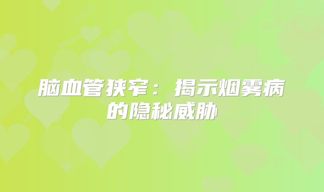 脑血管狭窄：揭示烟雾病的隐秘威胁