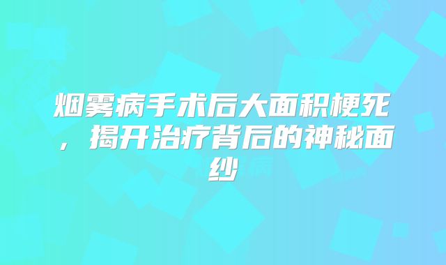 烟雾病手术后大面积梗死，揭开治疗背后的神秘面纱
