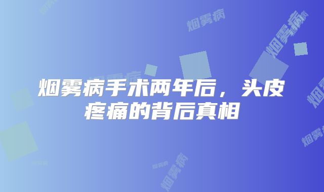 烟雾病手术两年后，头皮疼痛的背后真相