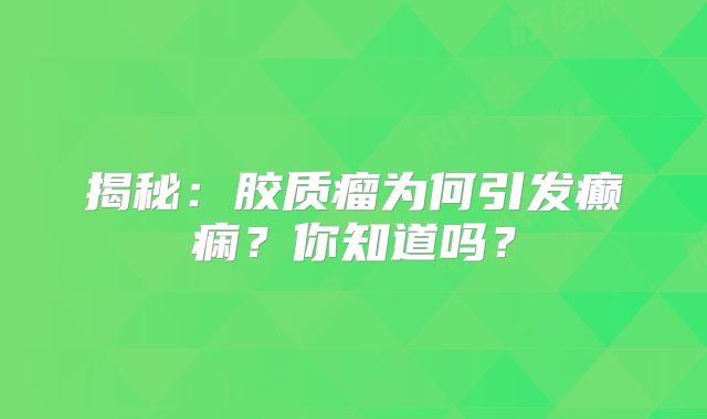 揭秘：胶质瘤为何引发癫痫？你知道吗？