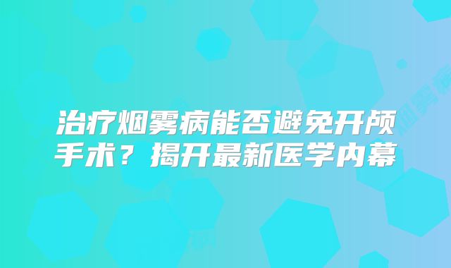 治疗烟雾病能否避免开颅手术？揭开最新医学内幕