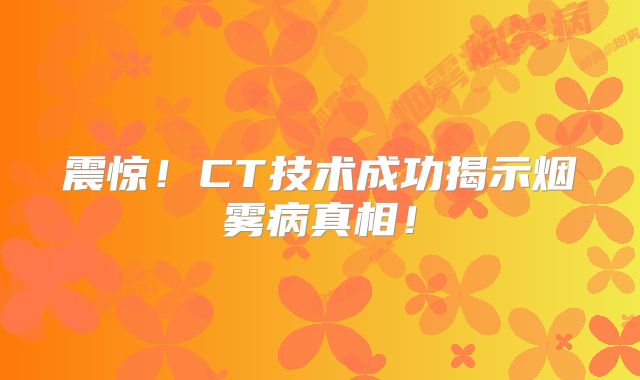 震惊！CT技术成功揭示烟雾病真相！
