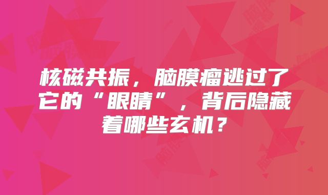 核磁共振，脑膜瘤逃过了它的“眼睛”，背后隐藏着哪些玄机？