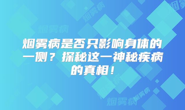烟雾病是否只影响身体的一侧？探秘这一神秘疾病的真相！