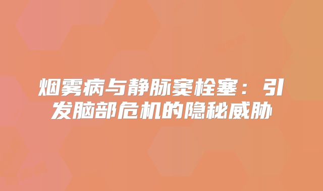 烟雾病与静脉窦栓塞：引发脑部危机的隐秘威胁