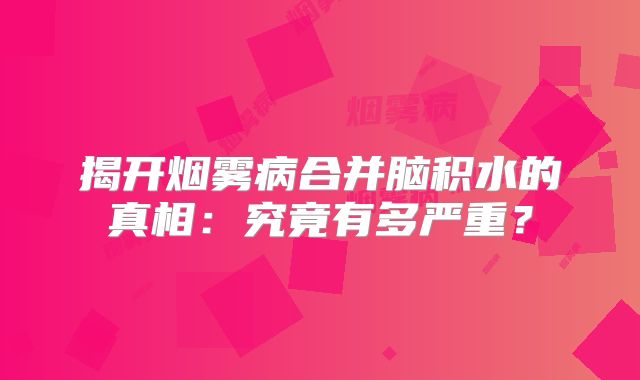揭开烟雾病合并脑积水的真相：究竟有多严重？