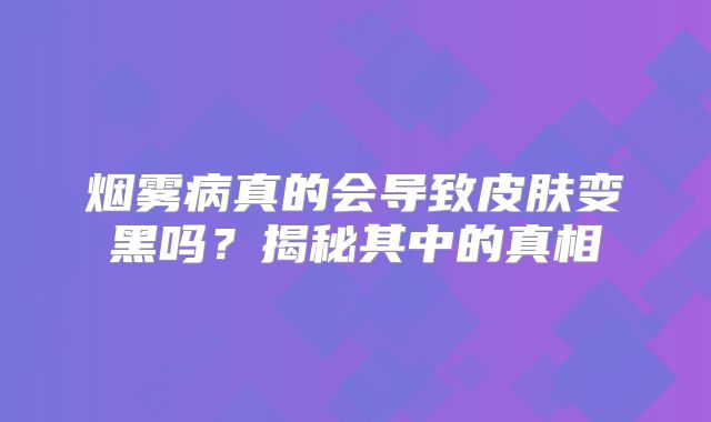烟雾病真的会导致皮肤变黑吗？揭秘其中的真相