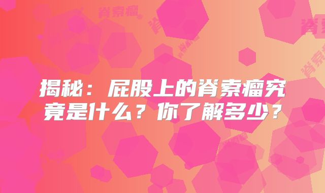 揭秘：屁股上的脊索瘤究竟是什么？你了解多少？