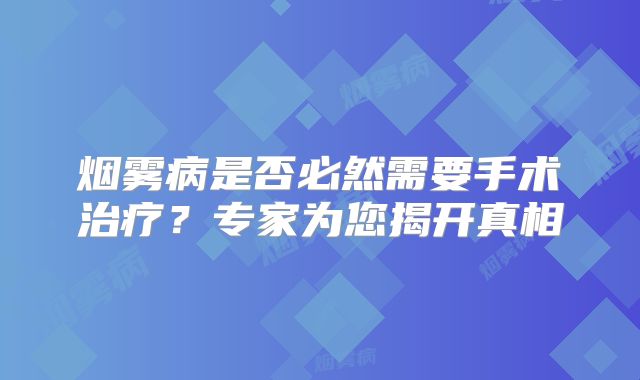 烟雾病是否必然需要手术治疗？专家为您揭开真相