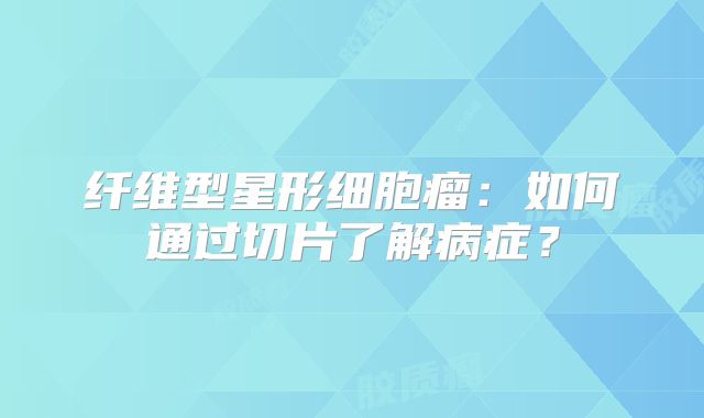 纤维型星形细胞瘤：如何通过切片了解病症？