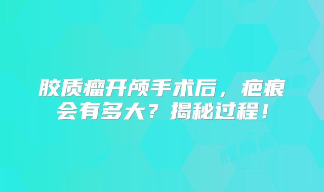 胶质瘤开颅手术后，疤痕会有多大？揭秘过程！