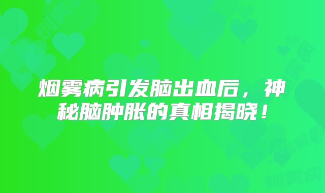 烟雾病引发脑出血后，神秘脑肿胀的真相揭晓！