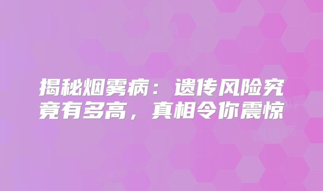 揭秘烟雾病：遗传风险究竟有多高，真相令你震惊