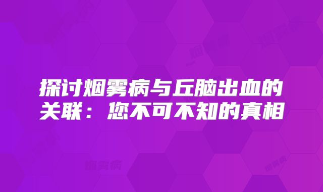探讨烟雾病与丘脑出血的关联：您不可不知的真相