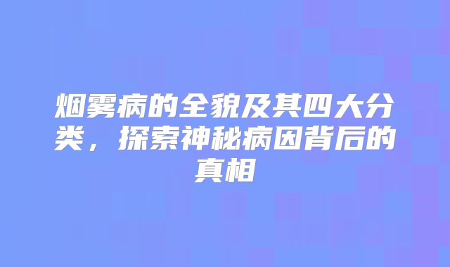 烟雾病的全貌及其四大分类，探索神秘病因背后的真相