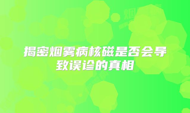 揭密烟雾病核磁是否会导致误诊的真相