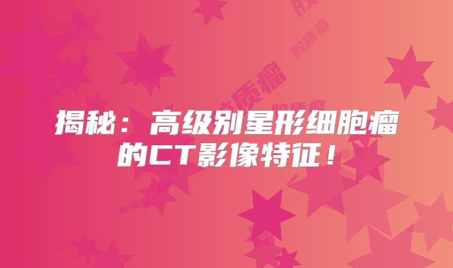 揭秘：高级别星形细胞瘤的CT影像特征！