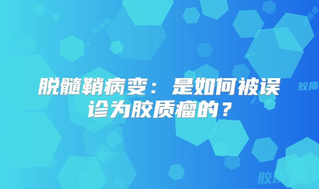 脱髓鞘病变：是如何被误诊为胶质瘤的？