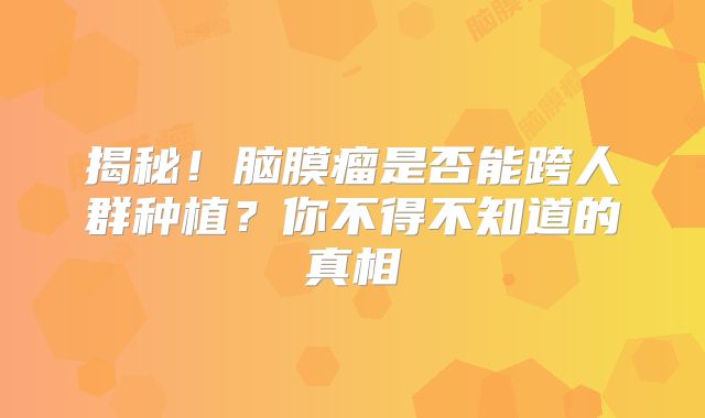 揭秘！脑膜瘤是否能跨人群种植？你不得不知道的真相