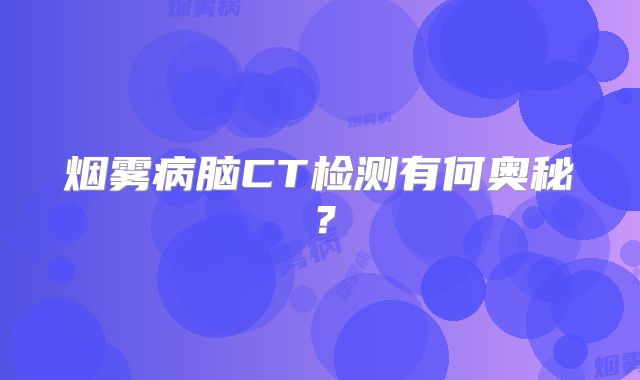 烟雾病脑CT检测有何奥秘？
