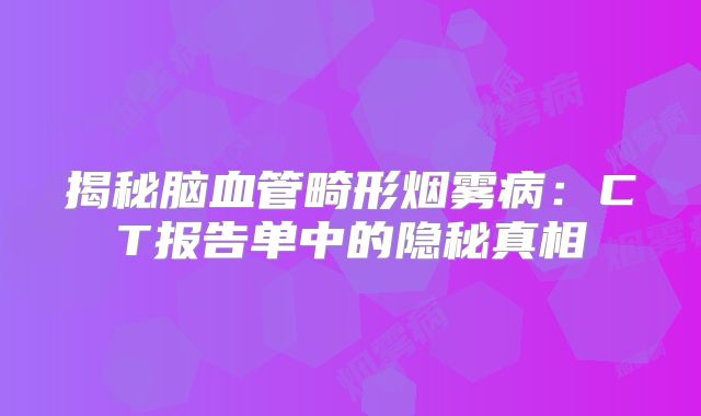 揭秘脑血管畸形烟雾病：CT报告单中的隐秘真相