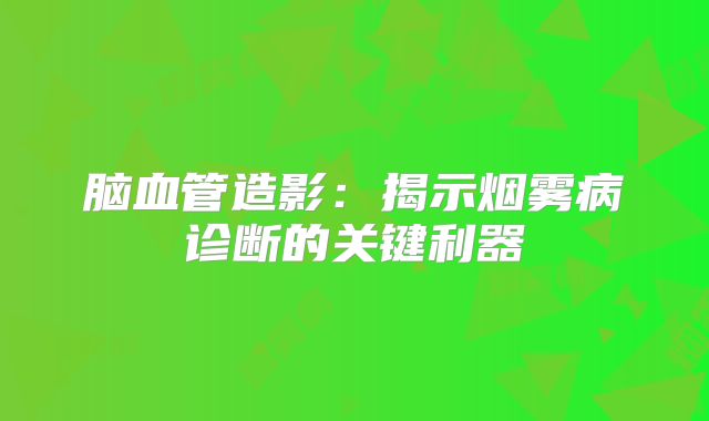 脑血管造影：揭示烟雾病诊断的关键利器