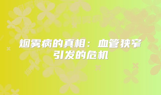 烟雾病的真相：血管狭窄引发的危机