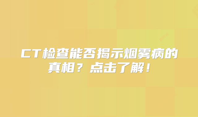 CT检查能否揭示烟雾病的真相？点击了解！