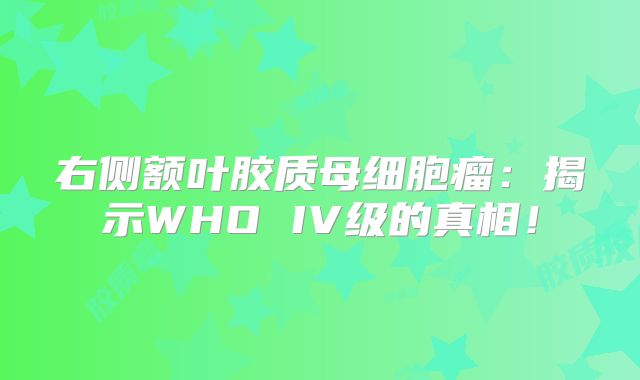 右侧额叶胶质母细胞瘤：揭示WHO IV级的真相！