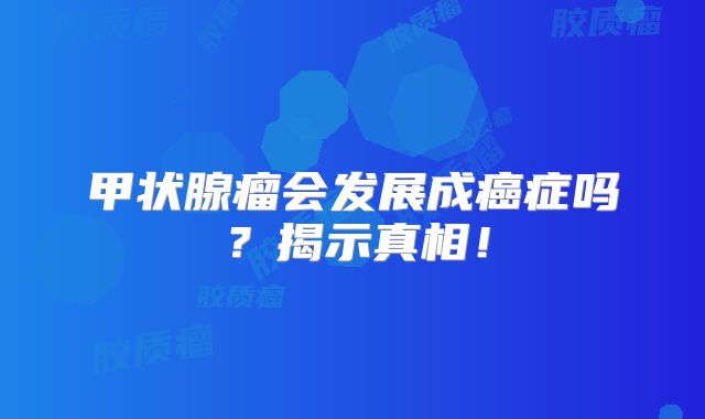 甲状腺瘤会发展成癌症吗？揭示真相！