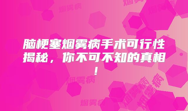 脑梗塞烟雾病手术可行性揭秘，你不可不知的真相！