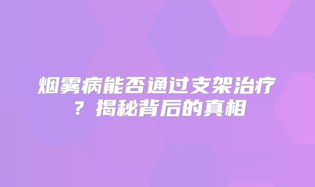 烟雾病能否通过支架治疗？揭秘背后的真相
