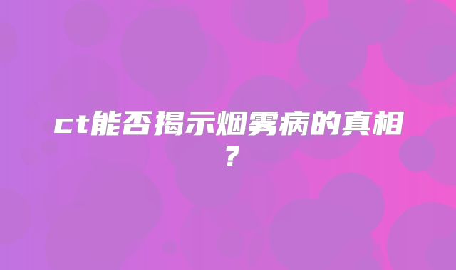 ct能否揭示烟雾病的真相？