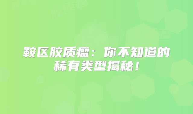 鞍区胶质瘤：你不知道的稀有类型揭秘！