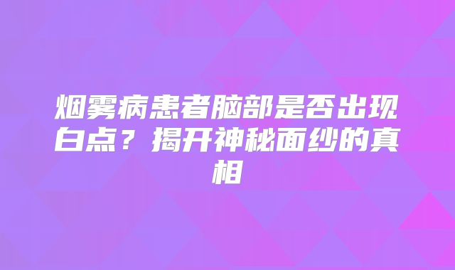 烟雾病患者脑部是否出现白点？揭开神秘面纱的真相