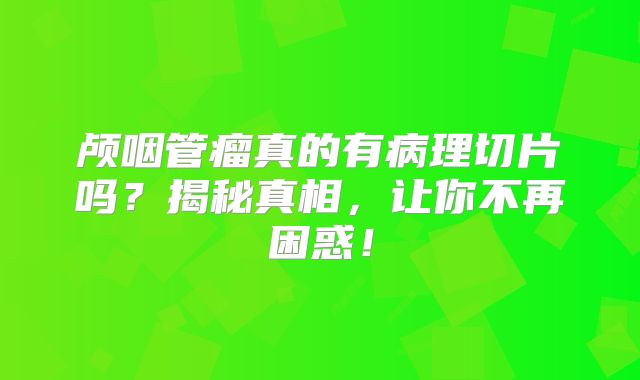 颅咽管瘤真的有病理切片吗？揭秘真相，让你不再困惑！