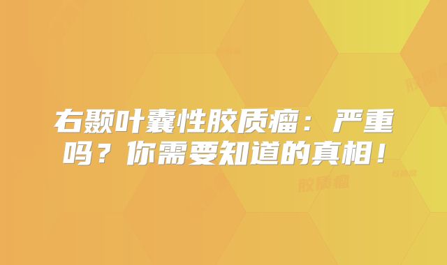 右颞叶囊性胶质瘤：严重吗？你需要知道的真相！