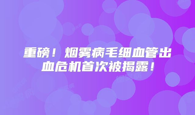 重磅！烟雾病毛细血管出血危机首次被揭露！