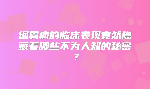 烟雾病的临床表现竟然隐藏着哪些不为人知的秘密？