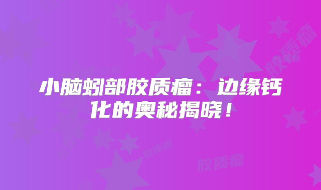 小脑蚓部胶质瘤：边缘钙化的奥秘揭晓！
