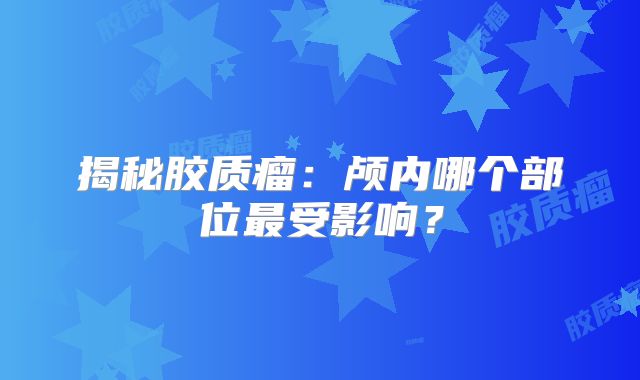 揭秘胶质瘤：颅内哪个部位最受影响？